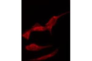 Image no. 1 for anti-Solute Carrier Family 6 (Neutral Amino Acid Transporter), Member 15 (SLC6A15) antibody (ABIN6258403)