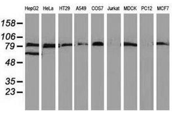 VCAM1 antibody