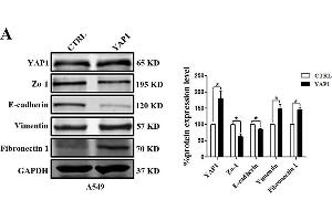 Image no. 6 for anti-Glyceraldehyde-3-Phosphate Dehydrogenase (GAPDH) antibody (ABIN3020541)