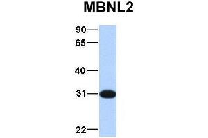 Image no. 2 for anti-Muscleblind-Like 2 (MBNL2) (Middle Region) antibody (ABIN2784554)