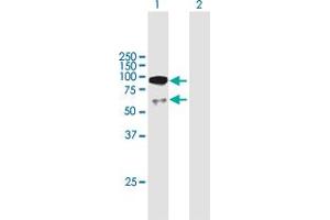 Image no. 1 for anti-UTP3, Small Subunit (SSU) Processome Component (UTP3) (AA 1-479) antibody (ABIN949516)