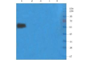 Western Blotting (WB) image for anti-IL2RA (Basiliximab Biosimilar) antibody (ABIN5668050)