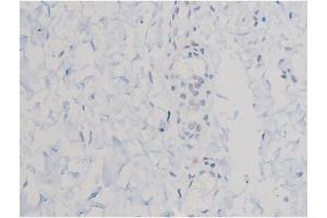Image no. 3 for anti-V-Akt Murine Thymoma Viral Oncogene Homolog 1 (AKT1) (pThr450) antibody (ABIN6256564)