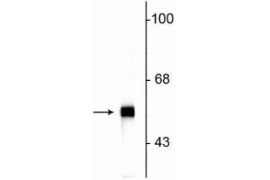 Image no. 2 for anti-Peripherin (PRPH) antibody (ABIN361363)