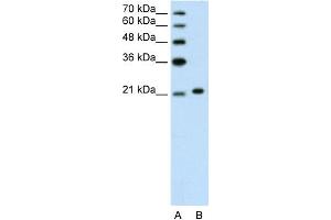 Image no. 3 for anti-Ankyrin 1, Erythrocytic (ANK1) (C-Term) antibody (ABIN2775478)
