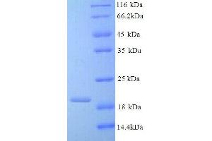 Interleukin 10 (IL10) (AA 19-178), (full length) protein (His tag)
