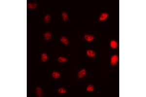anti-DNA Repair Protein Complementing XP-G Cells (ERCC5) (N-Term) antibody