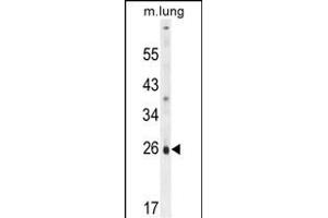 PQLC1 anticorps  (AA 100-128)