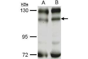 Image no. 3 for anti-Phosphoinositide-3-Kinase, Catalytic, beta Polypeptide (PIK3CB) (Internal Region) antibody (ABIN2856792)