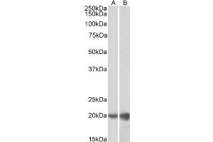 Image no. 2 for anti-Deoxyuridine Triphosphatase (DUT) (Internal Region) antibody (ABIN5539501)