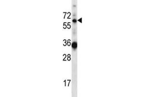 Image no. 1 for anti-GATA Zinc Finger Domain Containing 2B (GATAD2B) (AA 1-30) antibody (ABIN3028678)