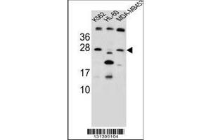 Image no. 1 for anti-Dickkopf Homolog 4 (Xenopus Laevis) (DKK4) (AA 162-189), (C-Term) antibody (ABIN655596)
