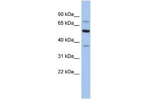 Image no. 1 for anti-Glycyl-tRNA Synthetase (GARS) (Middle Region) antibody (ABIN2787816)