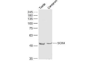 SOX4 anticorps  (AA 54-103)