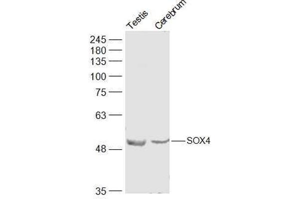 SOX4 anticorps  (AA 54-103)