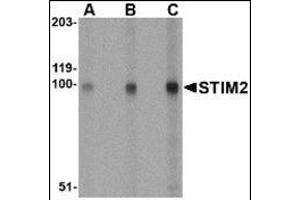 Image no. 2 for anti-Stromal Interaction Molecule 2 (Stim2) (Center) antibody (ABIN500831)