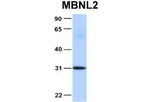 Image no. 3 for anti-Muscleblind-Like 2 (MBNL2) (Middle Region) antibody (ABIN2784554)