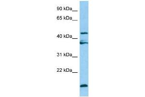 Image no. 1 for anti-Legumain (LGMN) (Middle Region) antibody (ABIN2790480)