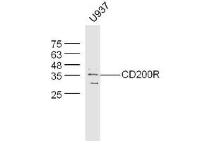 Image no. 2 for anti-CD200 Receptor 1-Like (CD200R1L) (AA 151-250) antibody (ABIN1715098)