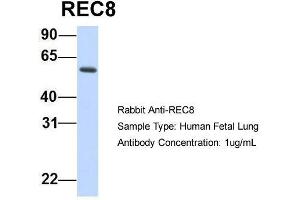 Image no. 3 for anti-REC8 Homolog (Yeast) (REC8) (N-Term) antibody (ABIN2783199)