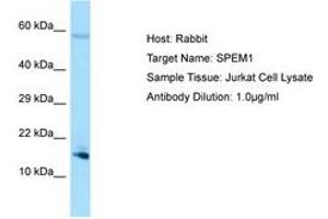 Image no. 1 for anti-Spermatid Maturation 1 (SPEM1) (AA 72-121) antibody (ABIN6750075)
