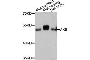 Image no. 1 for anti-Adenylate Kinase 8 (AK8) antibody (ABIN6292827)