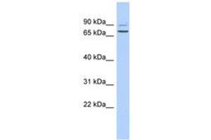 anti-Taperin (TPRN) (AA 420-469) antibody