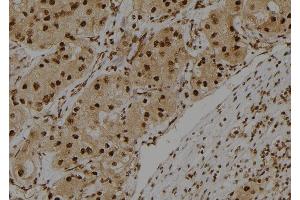 Image no. 1 for anti-S100 Calcium Binding Protein A3 (S100A3) (Internal Region) antibody (ABIN6257487)