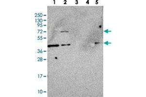 Image no. 1 for anti-Molybdenum Cofactor Synthesis 1 (MOCS1) antibody (ABIN5583674)
