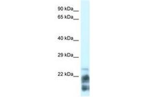 Image no. 1 for anti-Magnesium-Dependent Phosphatase 1 (MDP1) (N-Term) antibody (ABIN6742139)