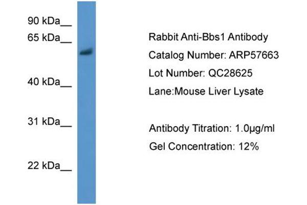 BBS1 antibody  (N-Term)