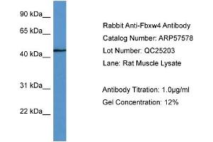 Image no. 2 for anti-F-Box and WD Repeat Domain Containing 4 (FBXW4) (C-Term) antibody (ABIN2787283)