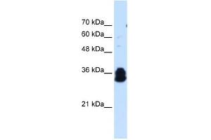 Image no. 2 for anti-Family with Sequence Similarity 134, Member B (FAM134B) (Middle Region) antibody (ABIN630359)
