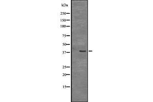 Image no. 1 for anti-CD109 (CD109) antibody (ABIN6257990)