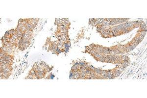 GLYT1 antibody
