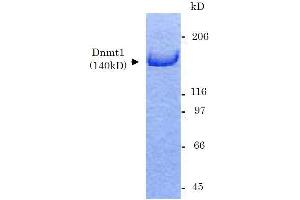 Image no. 2 for DNA (Cytosine-5)-Methyltransferase 1 (DNMT1) (Active) protein (ABIN2452167)