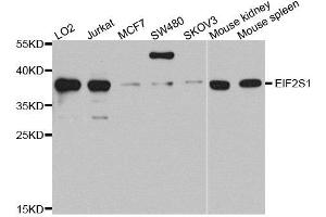 Image no. 2 for anti-Eukaryotic Translation Initiation Factor 2A, 65kDa (EIF2A) antibody (ABIN5663762)