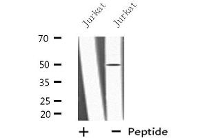 Image no. 1 for anti-Low Density Lipoprotein Receptor Related Protein 11 (LRP11) (Internal Region) antibody (ABIN6257816)
