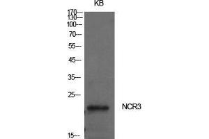 Image no. 2 for anti-Natural Cytotoxicity Triggering Receptor 3 (NCR3) (Internal Region) antibody (ABIN3181469)