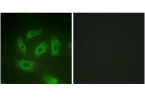 Image no. 2 for anti-Transforming Growth Factor, beta Receptor 1 (TGFBR1) (AA 131-180) antibody (ABIN1532728)