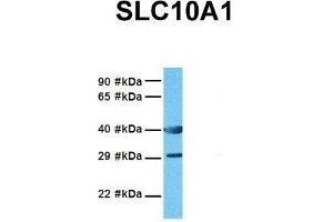 Image no. 3 for anti-Solute Carrier Family 10 (Sodium/bile Acid Cotransporter Family), Member 1 (SLC10A1) (Middle Region) antibody (ABIN2777141)