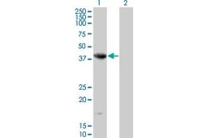Image no. 1 for anti-Endonuclease 8-like 2 (NEIL2) (AA 1-332) antibody (ABIN566974)