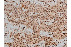 Image no. 6 for anti-Histone Deacetylase 3 (HDAC3) (pSer424) antibody (ABIN6256332)