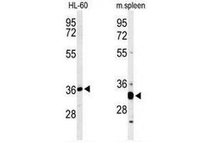 Image no. 3 for anti-ST8 alpha-N-Acetyl-Neuraminide alpha-2,8-Sialyltransferase 4 (ST8SIA4) (AA 193-222), (Middle Region) antibody (ABIN954963)