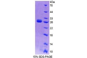 Image no. 1 for Dystrophia Myotonica-Protein Kinase (DMPK) (AA 1-201) protein (T7 tag,His tag) (ABIN6239118)