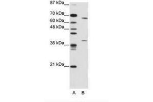 Image no. 2 for anti-Grainyhead-Like 3 (GRHL3) (AA 529-578) antibody (ABIN203223)
