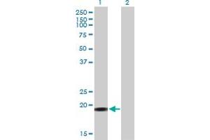 Image no. 1 for anti-Mitogen-Activated Protein Kinase Kinase Kinase 19 (MAP3K19) (AA 1-168) antibody (ABIN529183)