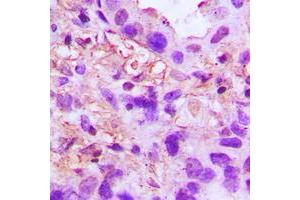 anti-Tumor Necrosis Factor-Inducible Protein 6 (TNFAIP6) (Center) antibody