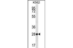 ZNF146 Antikörper  (N-Term)