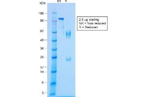 Image no. 1 for anti-NK2 Homeobox 2 (Nkx2-2) antibody (ABIN6940205)